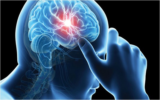 Beyin ve Nöroşirürji Kliniği